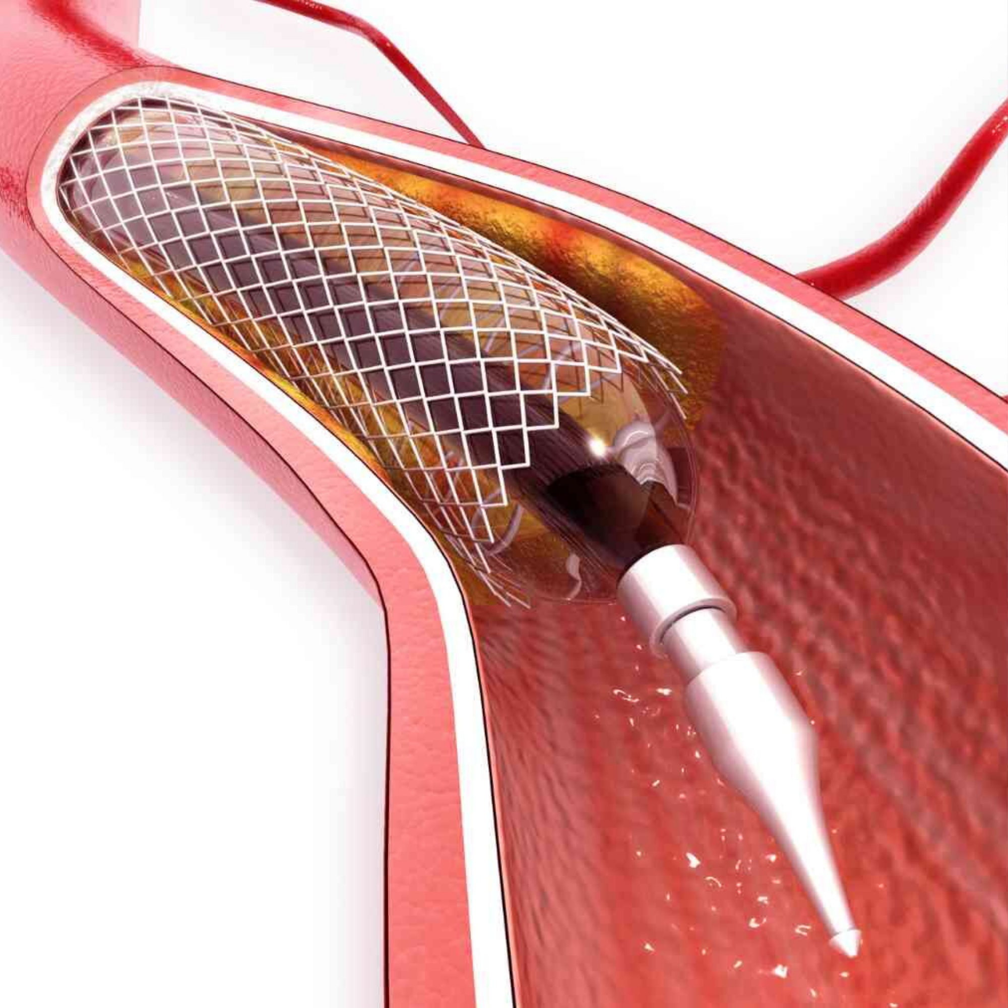 Cardiology